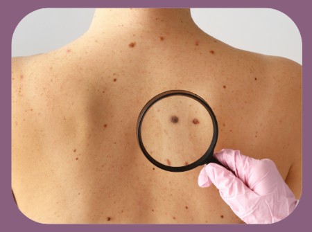 Ελιές σε Κρυφά Σημεία: Πότε Πρέπει να Ανησυχώ;